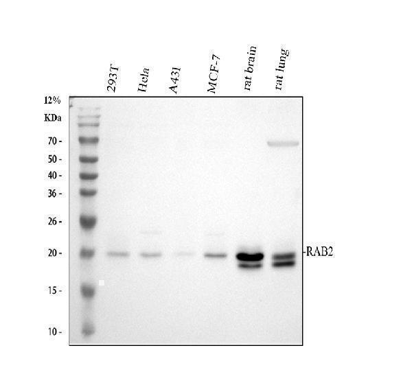  Western blot analysis of RAB2/RAB2A using anti-RAB2/RAB2A antibody (A06007-2)