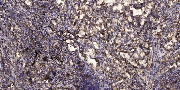 a06008 1 rit1 primary antibodies ihc testing 1