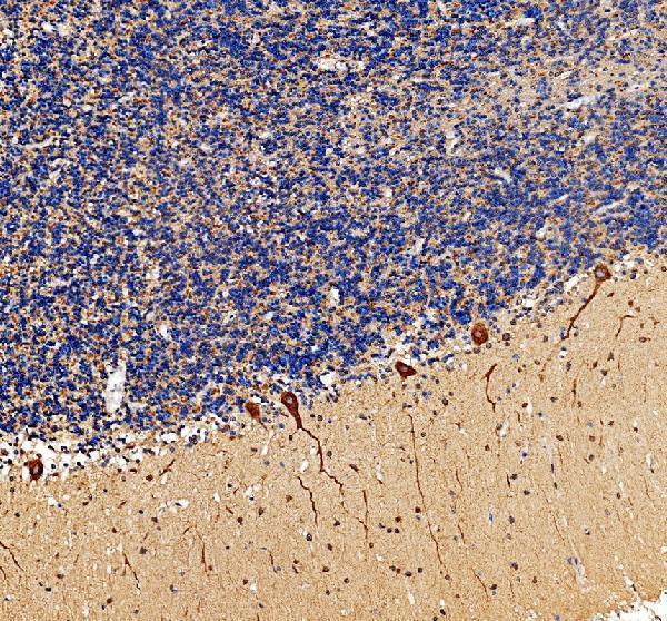 IHC analysis of DNER using anti-DNER antibody (A06011-1)