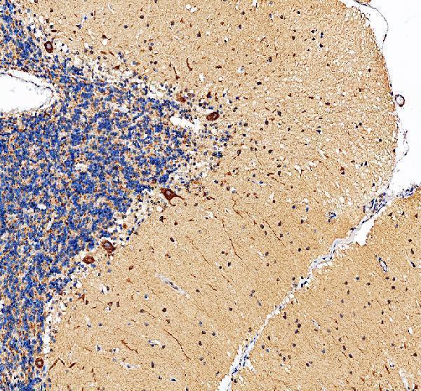 IHC analysis of DNER using anti-DNER antibody (A06011-1)