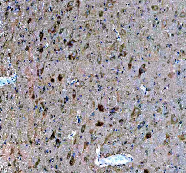 a06011 1 dner primary antibodies ihc testing 3