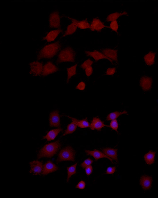 a06013 ngly1 primary antiboties if testing 2