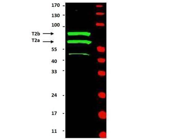 Western blot using Boster's Anti-Cyclin T2 (Rabbit) is shown to detect two major bands (arrowheads) corresponding to human Cyclin T2a (~74kDa) and T2b (~81kDa) as indicated