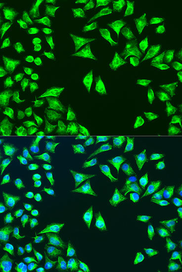 a06016 llgl1 primary antiboties if testing 2