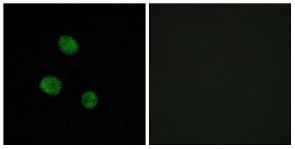 a06017 hnrnpm primary antibodies if testing 1
