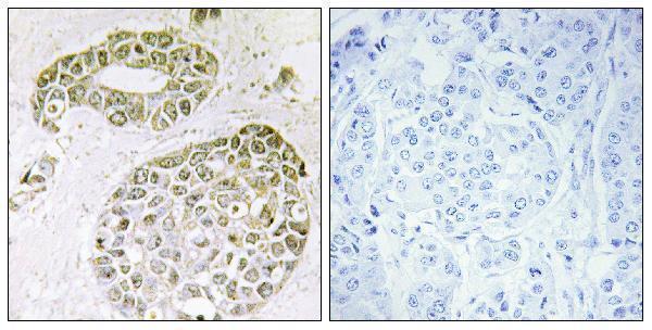 a06017 hnrnpm primary antibodies ihc testing 2