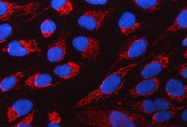 a06018 1 pycr1 primary antibodies if testing 4