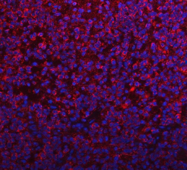 a06018 1 pycr1 primary antibodies if testing 5