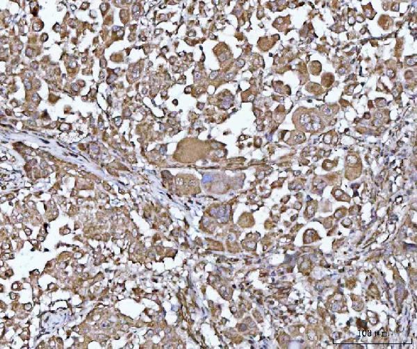  IHC analysis of PYCR1 using anti-PYCR1 antibody (A06018-1)