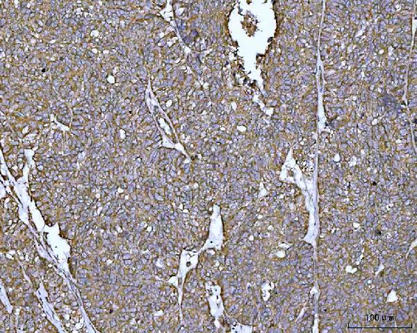  IHC analysis of PYCR1 using anti-PYCR1 antibody (A06018-1)