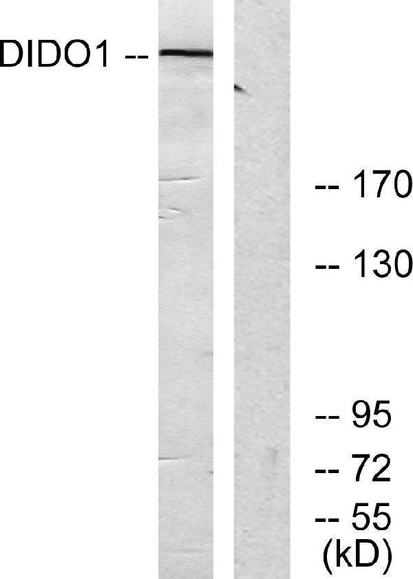 Western blot analysis of lysates from 293 cells, using DIDO1 Antibody