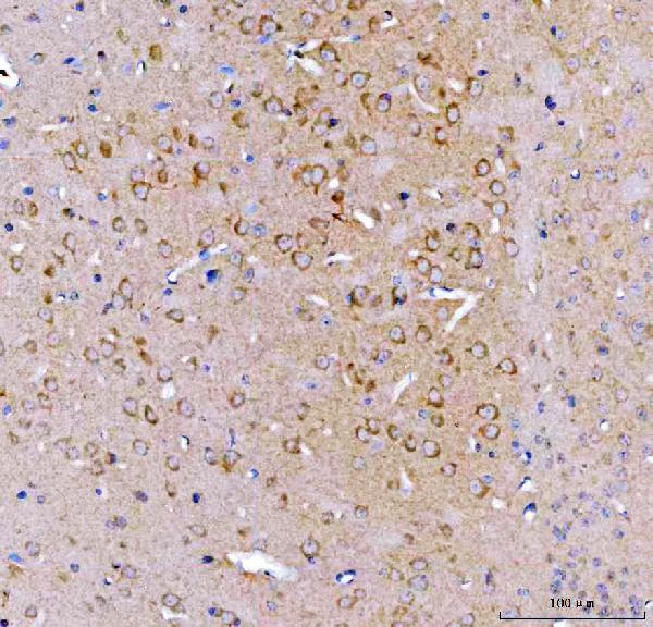 a06020 1 srgap3 primary antibodies ihc testing 2