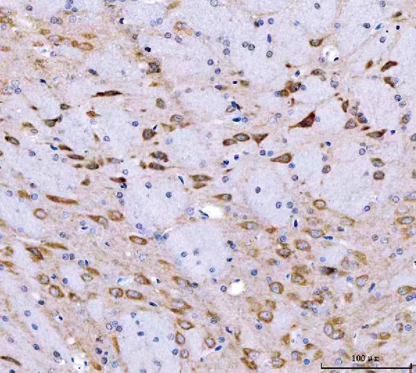 a06020 1 srgap3 primary antibodies ihc testing 3