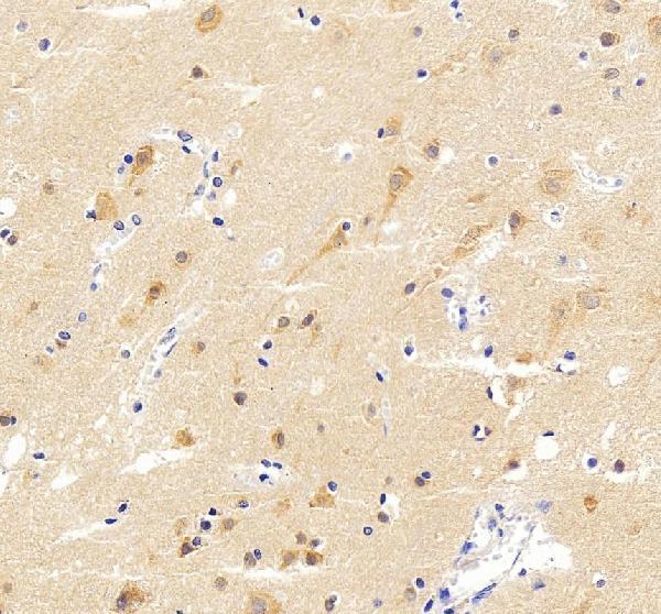 a06020 1 srgap3 primary antibodies ihc testing 4