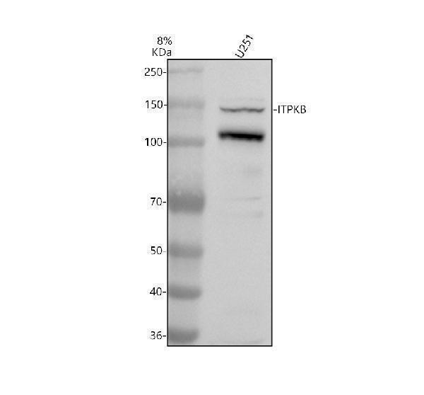 Western blot analysis of ITPKB using anti-ITPKB antibody (A06023-2)