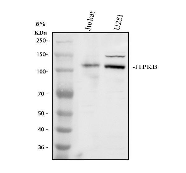 Western blot analysis of ITPKB using anti-ITPKB antibody (A06023-2)