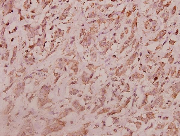 a06025 1 rpl7 primary antiboties ihc testing 2