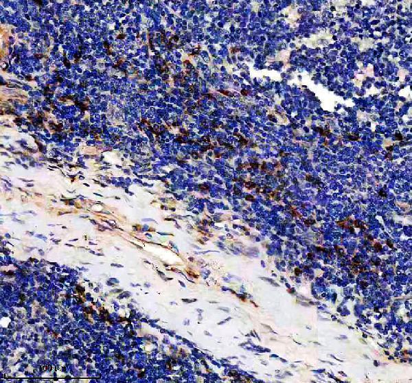 a06028 2 sprtn primary antibodies ihc testing 1