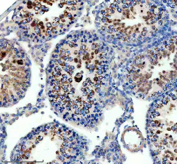 a06028 2 sprtn primary antibodies ihc testing 2