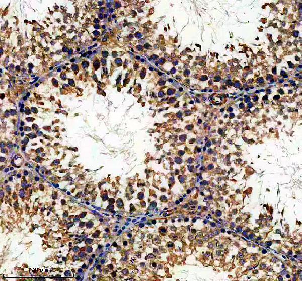 a06028 2 sprtn primary antibodies ihc testing 3
