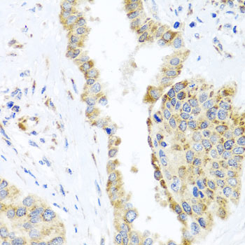 a06034 dars2 primary antiboties ihc testing 3
