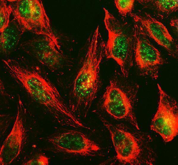  IF analysis of TOX3 using anti-TOX3 antibody (A06035-1) and anti-Beta Tubulin antibody (M01857-3)