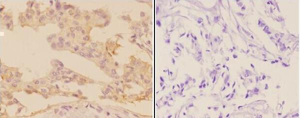 a06038 1 adcy9 primary antiboties ihc testing 2