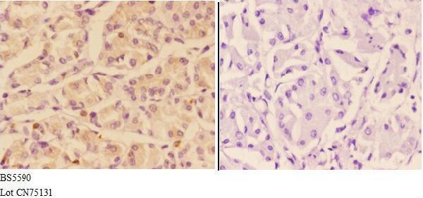 a06038 1 adcy9 primary antiboties ihc testing 3