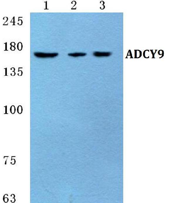 a06038 1 adcy9 primary antiboties wb testing 1