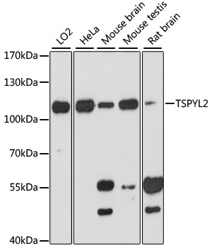 a06041 tspyl2 primary antiboties wb testing 1