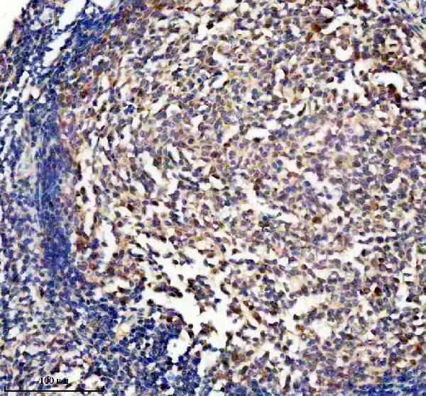 IHC analysis of DUSP2 using anti-DUSP2 antibody (A06043-1)