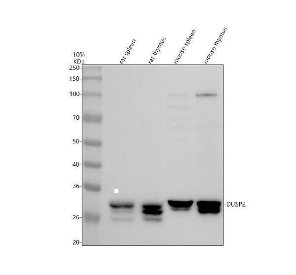 Western blot analysis of DUSP2 using anti-DUSP2 antibody (A06043-1)