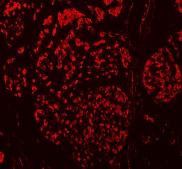a06044 2 tbx18 primary antibodies if testing 9