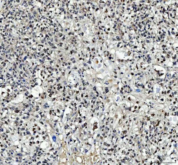 a06044 2 tbx18 primary antibodies ihc testing 4