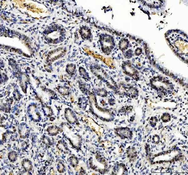 a06044 2 tbx18 primary antibodies ihc testing 5