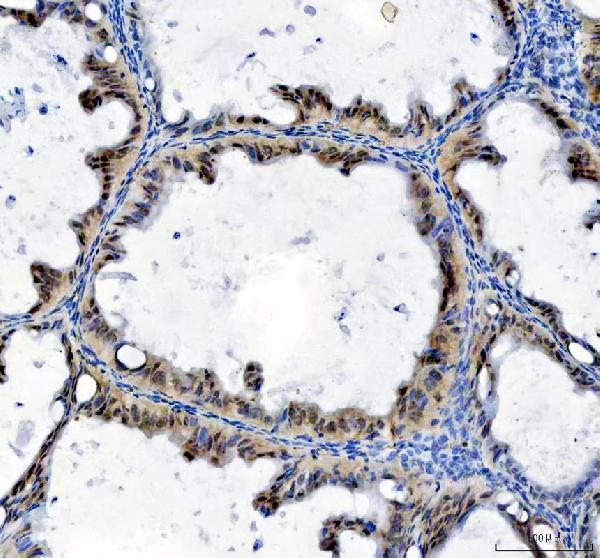 a06044 2 tbx18 primary antibodies ihc testing 6