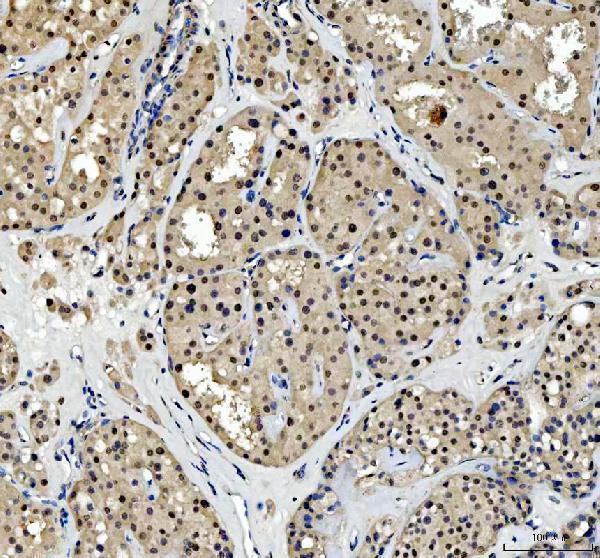 a06044 2 tbx18 primary antibodies ihc testing 7