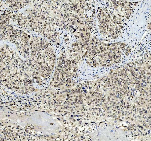 a06044 2 tbx18 primary antibodies ihc testing 8