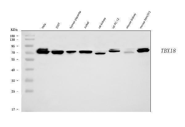  Western blot analysis of TBX18 using anti-TBX18 antibody (A06044-2)