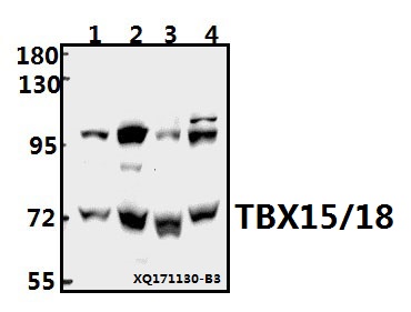 Western blot (WB) analysis of TBX15/18 (D164) pAb at 1:500 dilution
Lane1:A549 whole cell lysate(40ug)
Lane2:HEK293T whole cell lysate(40ug)
Lane3:The Lung tissue lysate of Rat(40ug)
Lane4:AML-12 whole cell lysate(40ug)