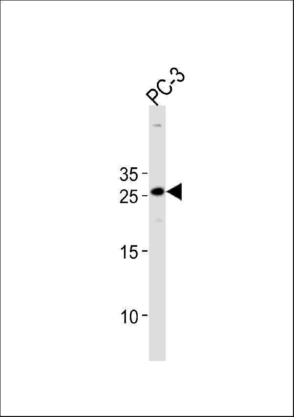 HOXC6 Antibody (C-term) western blot analysis in PC-3 cell line lysates (35ug/lane)