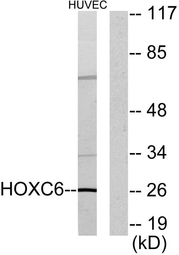 Western blot analysis of lysates from HUVEC cells, using HOXC6 Antibody