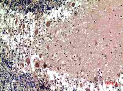 Immunohistochemistry (IHC) analysis of paraffin-embedded Human Brain, antibody was diluted at 1:100