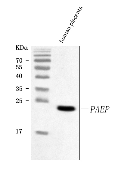  Western blot analysis of Glycodelin/PAEP using anti-Glycodelin/PAEP antibody (A06051-1)