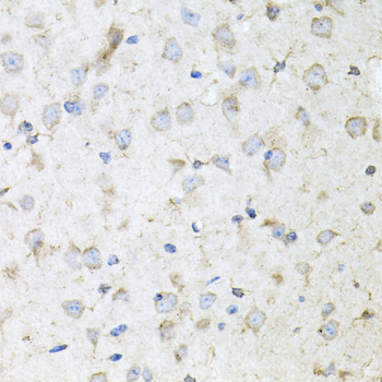 Immunohistochemistry of paraffin-embedded mouse brain using KLK11 antibody  at dilution of 1:100 