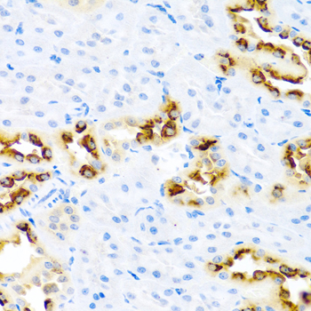 Immunohistochemistry of paraffin-embedded mouse lung using KLK11 antibody  at dilution of 1:100 