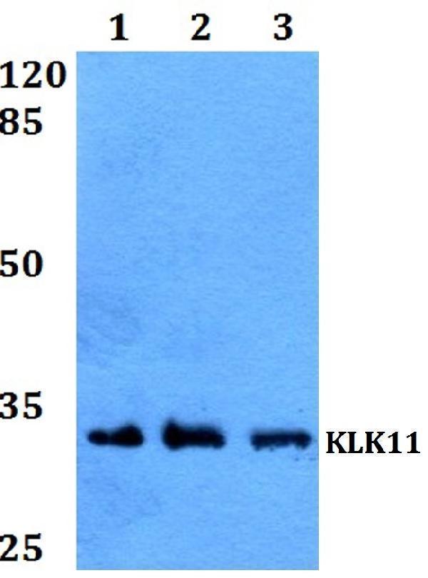 Western blot (WB) analysis of KLK11 polyclonal antibody at 1:500 dilution
Lane1:HEK293T whole cell lysate
Lane2:HepG2 whole cell lysate
Lane3:Rat brain tissue lysate