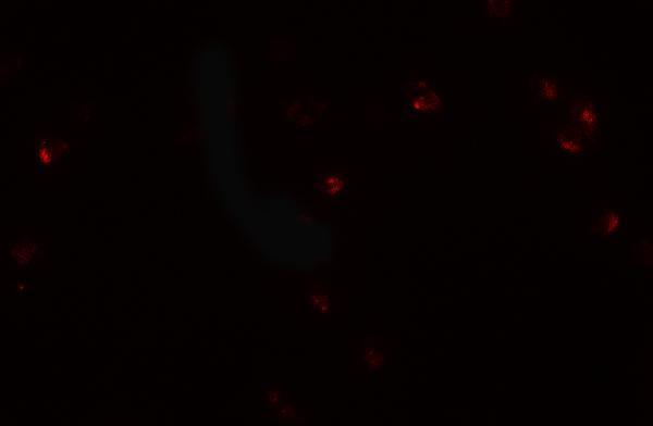 Immunofluorescence of CRIM1 in Jurkat cells with CRIM1 antibody at 20 μg/mL