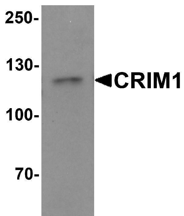 Western blot analysis of CRIM1 in Jurkat cell lysate with Crim1 antibody at 1 μg/mL