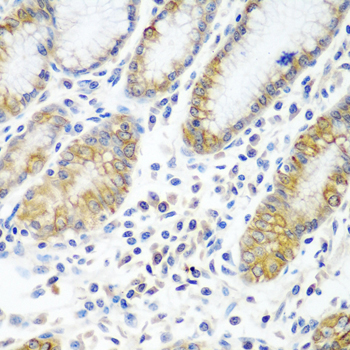 Immunohistochemistry of paraffin-embedded human stomach using ATAD3A antibody  at dilution of 1:100 